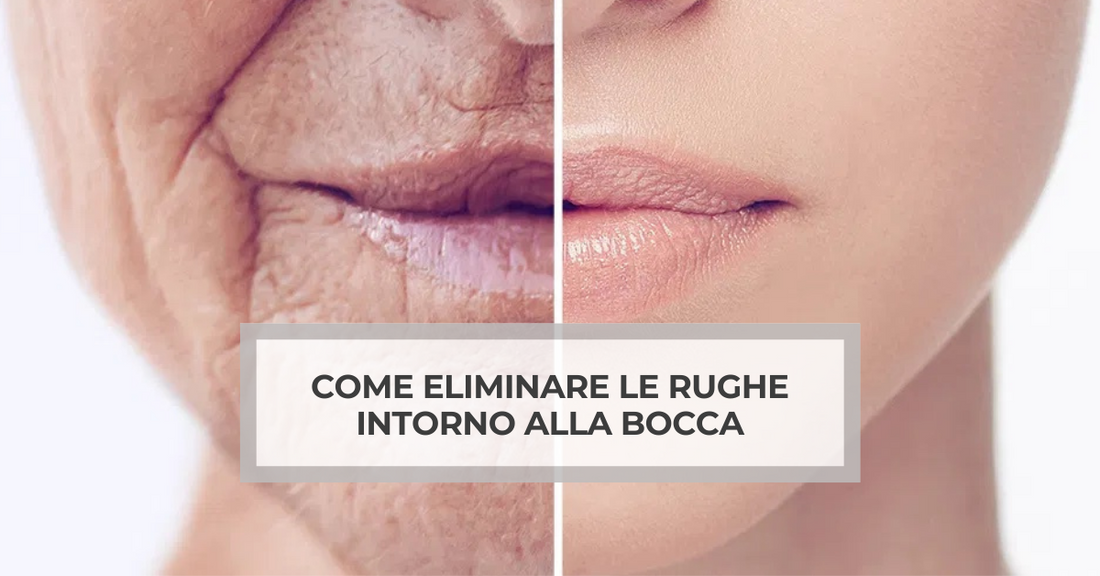 Rughe intorno alla bocca: perché si formano e perché la micro-infusione è più efficace